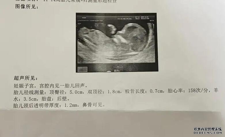 廈門包男孩 在廈門174醫院做試管流程和費用 ‘懷孕31周b超看男女準嗎’