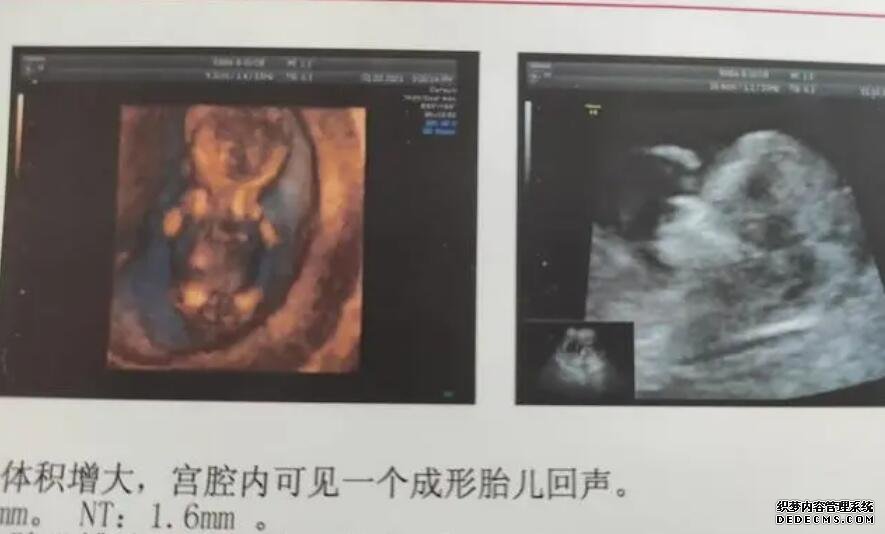 南京代孕?? 當地姐妹說說做試管選南京鼓樓醫院和江蘇省人醫哪個好？ ‘孕期男孩彩超圖’