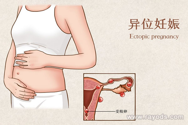 上海供卵多少錢?上海三代試管嬰兒血型要求