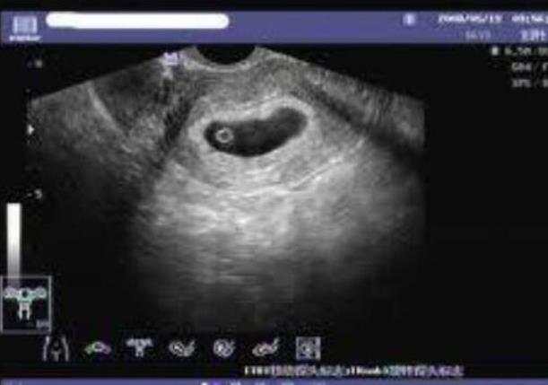 云南省第一人民醫院三代成功率 云南做供卵試管最受歡迎醫院排名 ‘b超寫的哪句有可能是男孩’