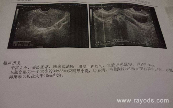 卵巢早衰 試管成功,南京助孕試管多少錢?