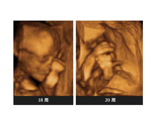 潮州市中心醫(yī)院人工授精指南