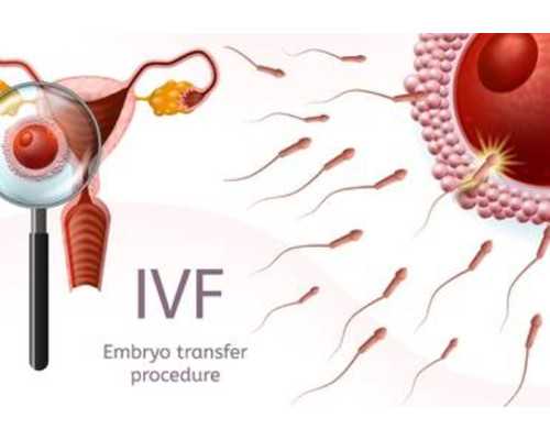 第二代試管嬰兒技術(shù)到底是怎么回事