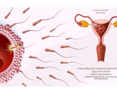 弓形子宮做試管懷雙胞胎的條件和真實故事