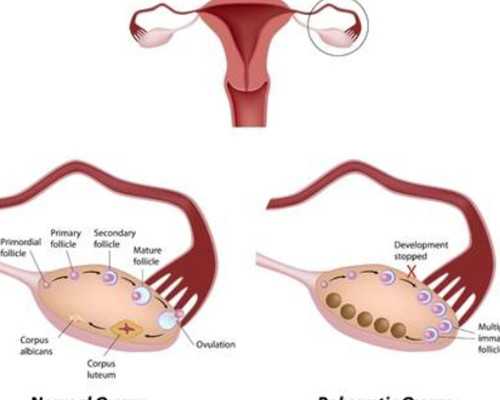 嚴重少精弱精做試管，成功率會怎樣