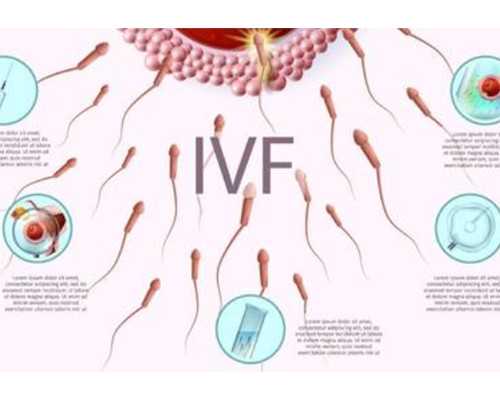 東莞試管嬰兒醫生怎么選