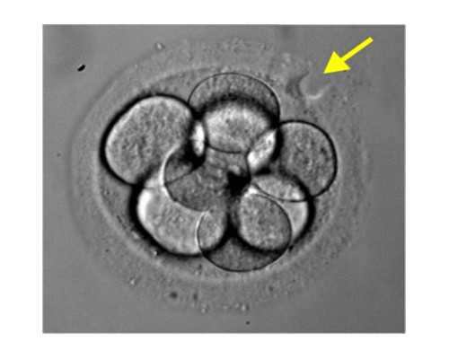 廣州助孕公司怎么選？這些優勢值得了解